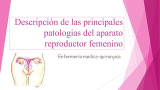 Descripción de las principales
patologias del aparato
reproductor femenino
Enfermería medico-quirurgica
 