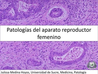 Patologías del aparato reproductor
femenino
Julissa Medina Hoyos, Universidad de Sucre, Medicina, Patología
 