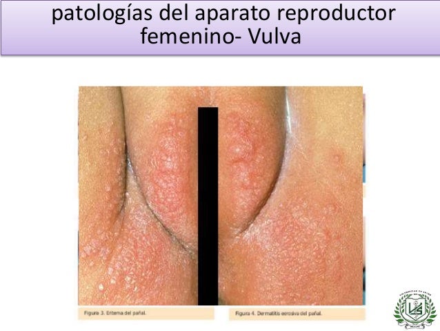 El audiolibro perfeccionamos en el cuerpo. El adelgazamiento psicológico