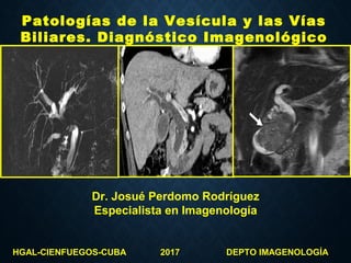 Patologías de la Vesícula y las Vías
Biliares. Diagnóstico Imagenológico
Dr. Josué Perdomo Rodríguez
Especialista en Imagenología
HGAL-CIENFUEGOS-CUBA 2017 DEPTO IMAGENOLOGÍA
 