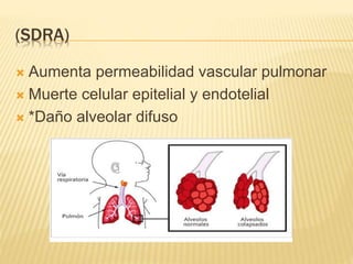 (SDRA) 
 Aumenta permeabilidad vascular pulmonar 
 Muerte celular epitelial y endotelial 
 *Daño alveolar difuso 
 