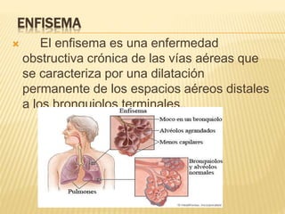 ENFISEMA 
 El enfisema es una enfermedad 
obstructiva crónica de las vías aéreas que 
se caracteriza por una dilatación 
permanente de los espacios aéreos distales 
a los bronquiolos terminales.. 
 