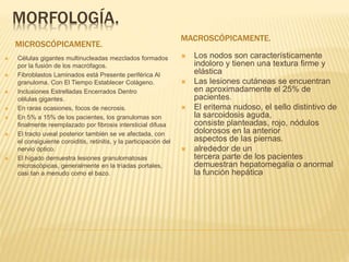 MORFOLOGÍA. 
MICROSCÓPICAMENTE. 
MACROSCÓPICAMENTE. 
 Células gigantes multinucleadas mezclados formados 
por la fusión de los macrófagos. 
 Fibroblastos Laminados está Presente periférica Al 
granuloma. Con El Tiempo Establecer Colágeno. 
 Inclusiones Estrelladas Encerrados Dentro 
células gigantes. 
 En raras ocasiones, focos de necrosis. 
 En 5% a 15% de los pacientes, los granulomas son 
finalmente reemplazado por fibrosis intersticial difusa 
 El tracto uveal posterior también se ve afectada, con 
el consiguiente coroiditis, retinitis, y la participación del 
nervio óptico. 
 El hígado demuestra lesiones granulomatosas 
microscópicas, generalmente en la tríadas portales, 
casi tan a menudo como el bazo. 
 Los nodos son característicamente 
indoloro y tienen una textura firme y 
elástica 
 Las lesiones cutáneas se encuentran 
en aproximadamente el 25% de 
pacientes. 
 El eritema nudoso, el sello distintivo de 
la sarcoidosis aguda, 
consiste planteadas, rojo, nódulos 
dolorosos en la anterior 
aspectos de las piernas. 
 alrededor de un 
tercera parte de los pacientes 
demuestran hepatomegalia o anormal 
la función hepática 
 