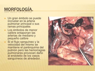 MORFOLOGÍA. 
 Un gran émbolo se puede 
incrustar en la arteria 
pulmonar principal o sus 
ramas principales 
 Los émbolos de menor 
calibre entaponan las 
arterias de mediano y 
pequeño calibre 
 Si el flujo sanguíneo y la 
velocidad del mismo se 
mantiene el parénquima del 
pulmón pero las hemorragias 
pulmonares provocan daño 
al endotelio de los vasos 
sanguíneos de alrededor. 
 
