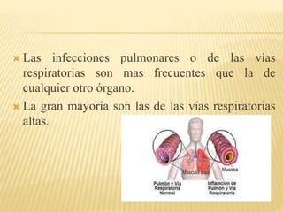  Las infecciones pulmonares o de las vías 
respiratorias son mas frecuentes que la de 
cualquier otro órgano. 
 La gran mayoría son las de las vías respiratorias 
altas. 
 