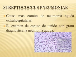 STREPTOCOCCUS PNEUMONIAE 
 Causa mas común de neumonía aguda 
extrahospitalaria. 
 El examen de esputo de teñido con gram 
diagnostica la neumonía aguda. 
 