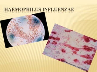 HAEMOPHILUS INFLUENZAE 
 