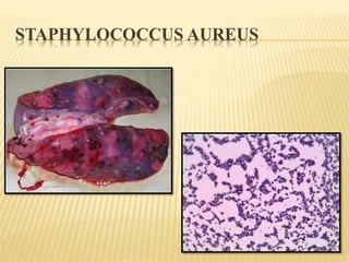 STAPHYLOCOCCUS AUREUS 
 