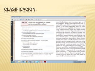 CLASIFICACIÓN. 
 