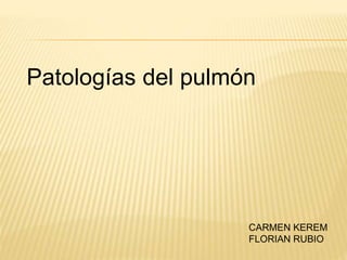 Patologías del pulmón 
CARMEN KEREM 
FLORIAN RUBIO 
 