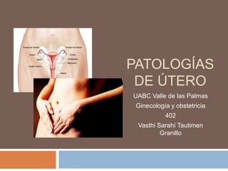 PATOLOGÍAS
DE ÚTERO
UABC Valle de las Palmas
Ginecología y obstetricia
402

Vasthi Sarahí Tautimen
Granillo

 