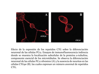 Efecto de la expresión de los repetidos CTG sobre la diferenciación
neuronal de las células PC12. Ensayos de inmunofluorescencia indirecta
donde se muestra la localización subcelular de la proteína a-tubulina,
componente esencial de los microtúbulos. Se observa la diferenciación
neuronal de las células PC12 silvestres (A) y la ausencia de neuritas en las
células CTG90 (B), las cuales expresan un número anormal de repetidos
CTG.

 