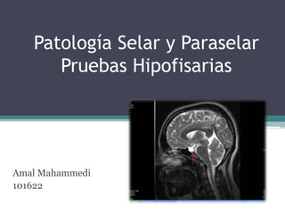 Patología Selar y Paraselar
      Pruebas Hipofisarias




Amal Mahammedi
101622
 
