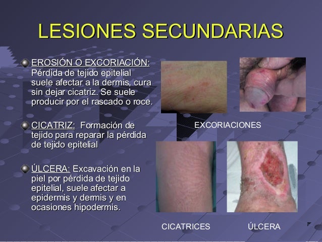 Patologías frecuentes de la piel