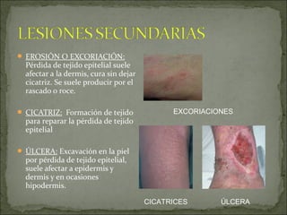 Patologías frecuentes de la piel | PPT