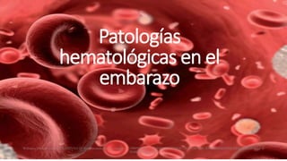 Patologías
hematológicas en el
embarazo
Williams. Obstetricia, 24e CAPÍTULO 56: Enfermedades hematológicas OBSTETRICIA GONZALEZ MERLO 7MA EDICION, ENFERMEDADES HEMATOLOGICAS E
INMUNOLOGICAS
 