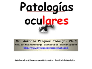 Patologías
oculares
Dr. Antonio Vásquez Hidalgo, Ph.D
Médico Microbiólogo Salubrista Investigador
http://www.investigacionvasquez.webs.com
Colaborador Adhonorem en Optometría . Facultad de Medicina
 