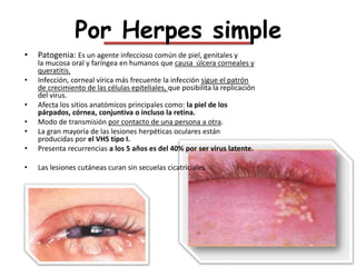 Por Herpes zoster
• Patogenia: Se trata de una reactivación del
virus varicela-zóster. Es una
ganglioradiculoneuritis.
• L...