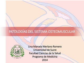 PATOLOGÍAS DEL SISTEMA OSTEOMUSCULAR
Lina Marcela Merlano Romero
Universidad de Sucre
Facultad Ciencias de la Salud
Programa de Medicina
2014
 