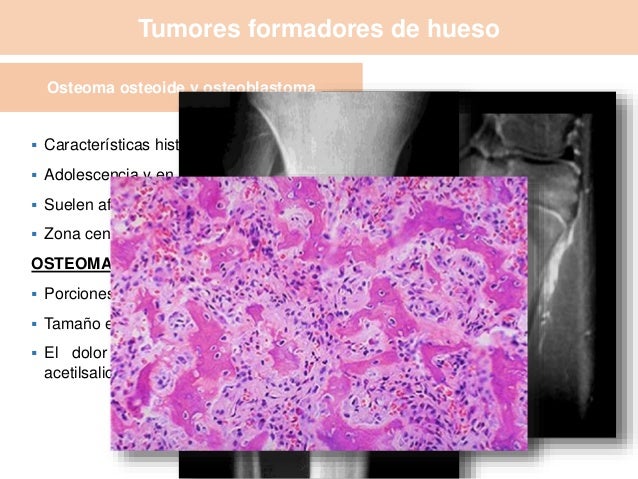 Patologías del sistema osteomuscular