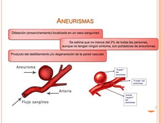 ANEURISMAS
Dilatación (ensanchamiento) localizada en un vaso sanguíneo

                                       Se estima que no menos del 2% de todas las personas,
                                   aunque no tengan ningún síntoma, son portadoras de aneurismas.

Producto del debilitamiento y/o degeneración de la pared vascular
 
