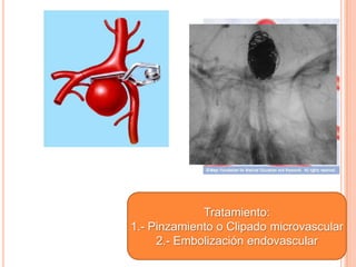 Tratamiento:
1.- Pinzamiento o Clipado microvascular
     2.- Embolización endovascular
 