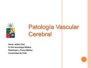 Patología Vascular
                      Cerebral
•Oscar Jeldes Díaz.
•IV Año tecnología Médica

•Radiología y Física Médica

•Universidad de Chile
 