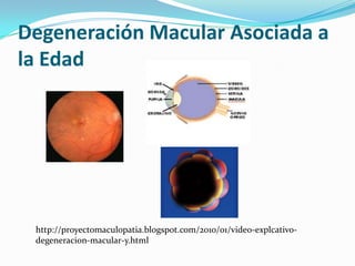 Degeneración Macular Asociada a
la Edad




 http://proyectomaculopatia.blogspot.com/2010/01/video-explcativo-
 degeneracion-macular-y.html
 