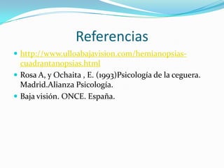 Referencias
 http://www.ulloabajavision.com/hemianopsias-
  cuadrantanopsias.html
 Rosa A, y Ochaita , E. (1993)Psicología de la ceguera.
  Madrid.Alianza Psicología.
 Baja visión. ONCE. España.
 