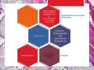 Estrechamiento
aterosclerótico
progresivo de
la
vascularización
en la edad
avanzada.
Estadio terminal de orquitis
inflamatoria
Criptorquidia
Admón..
Prolongada
de
hormonas
femeninas
Malnutrición
generalizada o
caquexia
IrritaciónHipopituitarismo
 