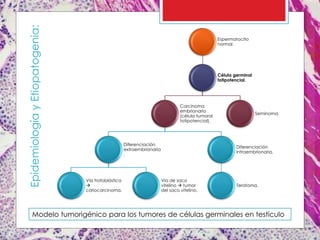 Modelo tumorigénico para los tumores de células germinales en testículo
EpidemiologíayEtiopatogenia: Espermatocito
normal.
Célula germinal
totipotencial.
Carcinoma
embrionario
(célula tumoral
totipotencial).
Diferenciación
extraembrionaria
.
Vía trofoblástica

coriocarcinoma.
Vía de saco
vitelino  tumor
del saco vitelino.
Diferenciación
intraembrionaria.
Teratoma.
Seminoma.
 