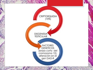 CRIPTORQUIDIA
(10%)
DISGENESIA
TESTICULAR
FACTORES
GENETICOS
(brazo corto del
cromosoma 12);
alteración en el
gen DAD-R
 