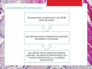 Las células tienen aspecto epitelial,
grandes, de aspecto embrionario con
núcleos hipercrómicos y nucléolos
prominentes.
Las células crecen adoptando patrones
alveolares o tubulares.
Se presentan usualmente a los 20-30
años de edad.
Carcinoma Embrionario:
 