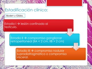 Estadificación clínica:
Estadio I  lesión confinada al
testículo.
Estadio II  compromiso ganglionar
retroperitoneal (IIA < 2 cm, IIB > 2 cm)
Estadio III  compromiso nodular
supradiafragmático o compromiso
visceral.
Boden y Gibbs.
 
