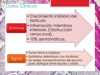 Datos Clínicos:
• Crecimiento indoloro del
testículo.
• Inflamación miembros
inferiores (Obstrucción
venocaval).
• 10% asintomáticos.
Síntomas
• Tumor firme e indoloro.
• Epidídimo delimitado con facilidad.
• Se realiza transiluminación del escroto
para distinguir entre líquido y sólido.
Signos
 