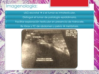 Imagenología:
USG escrotal  si el tumor es intratesticular.
Distinguir el tumor de patología epididimaria.
Facilitar exploración testicular en presencia de hidrocele.
Rx tórax y TC de abdomen y pelvis  metástasis.
 
