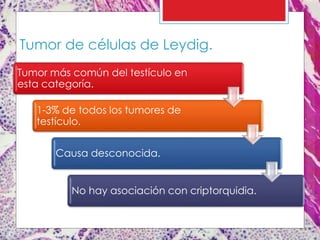 Tumor de células de Leydig.
Tumor más común del testículo en
esta categoría.
1-3% de todos los tumores de
testículo.
Causa desconocida.
No hay asociación con criptorquidia.
 
