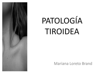 PATOLOGÍA
TIROIDEA
Mariana Loreto Brand
 