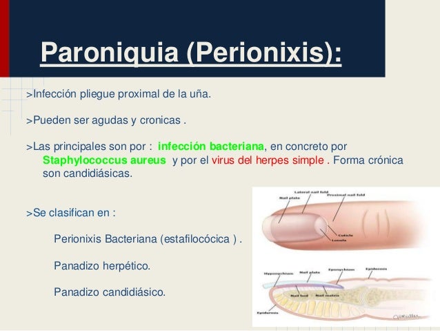 Los métodos públicos de atopicheskogo de la dermatitis