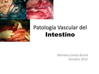 Patología Vascular del
Intestino
Mariana Loreto Brand
Octubre 2012
 