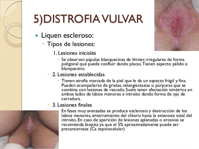 Los productos tyanshi a la psoriasis