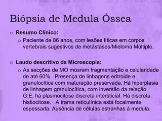 Biópsia de Medula Óssea
o Resumo Clínico:
   o Paciente de 86 anos, com lesões líticas em corpos
     vertebrais sugestivos de metástases/Mieloma Múltiplo.

o Laudo descritivo da Microscopia:
   o As secções de MO mosram fragmentação e celularidade
     de até 60%. Presença de linhagens eritroide e
     granulocítica com maturação preservada. Há hiperplasia
     de linhagem granulocítica, com inversão da relação
     G:E, há plasmocitose discreta intersticial. Há discreta
     histiocitose. A trama reticulínica está focalmente
     espessada. Ausência de células estranhas à medula.
 