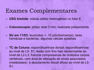 Exames Complementares
o USG tireóide: nódulo sólido heterogêneo no lobo E

o Colonoscopia: pólipo retal 3 mm; realizada polipectomia.

o SU em 11/03: leucócitos +, 10 piócitos/campo; raras
  hemácias e bactérias; algumas células epiteliais

o TC de Coluna: espondiloartrose dorsal; espondiloartrose
  ao nível de L5- S1; lesão com fino halo esclerosante ao
  nível de L2-L3; fraturas compressivas de múltiplos corpos
  vertebrais, com área de alteração de sinais associados
  (metástases) e abaulamento discal difuso ao nível de L5-
  S1.
 