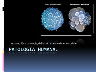 Introducción a patología, definición y causas de lesión celular.
PATOLOGÍA HUMANA.
 