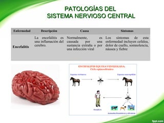 PATOLOGÍAS DELPATOLOGÍAS DEL
SISTEMA NERVIOSO CENTRALSISTEMA NERVIOSO CENTRAL
Enfermedad Descripción Causa Síntomas
Encefalitis
La encefalitis es
una inflamación del
cerebro.
Normalmente, es
causada por una
sustancia extraña o por
una infección viral
Los síntomas de esta
enfermedad incluyen cefalea,
dolor de cuello, somnolencia,
náusea y fiebre
 