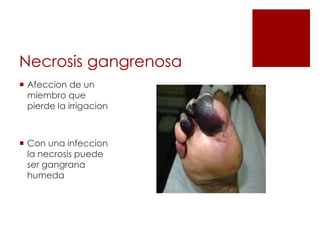 Necrosis gangrenosa
 Afeccion de un
miembro que
pierde la irrigacion
 Con una infeccion
la necrosis puede
ser gangrana
humeda
 