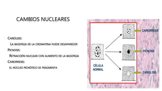 CAMBIOS NUCLEARES
• CARIÓLISIS:
LA BASOFILIA DE LA CROMATINA PUEDE DESAPARECER
• PICNOSIS:
RETRACCIÓN NUCLEAR CON AUMENTO DE LA BASOFILIA
• CARIORREXIS:
EL NÚCLEO PICNÓTICO SE FRAGMENTA
 