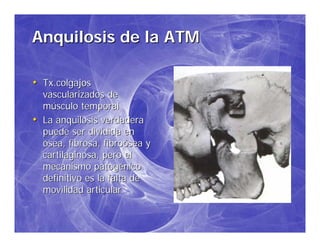 Patologia De Atm