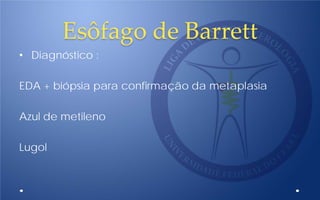 Esôfago de Barrett
• Diagnóstico :
EDA + biópsia para confirmação da metaplasia
Azul de metileno
Lugol
 