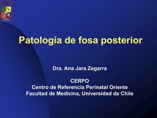Patología de fosa posterior
Dra. Ana Jara Zegarra
CERPO
Centro de Referencia Perinatal Oriente
Facultad de Medicina, Universidad de Chile
 